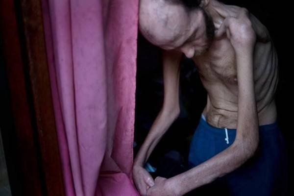 Murió Fabián Tomasi, víctima de los agrotóxicos