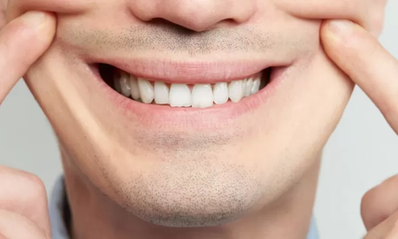 ¿Qué es la depresión sonriente, qué puede provocarla y cómo tratarla? ¿Qué es la depresión sonriente, qué puede provocarla y cómo tratarla?