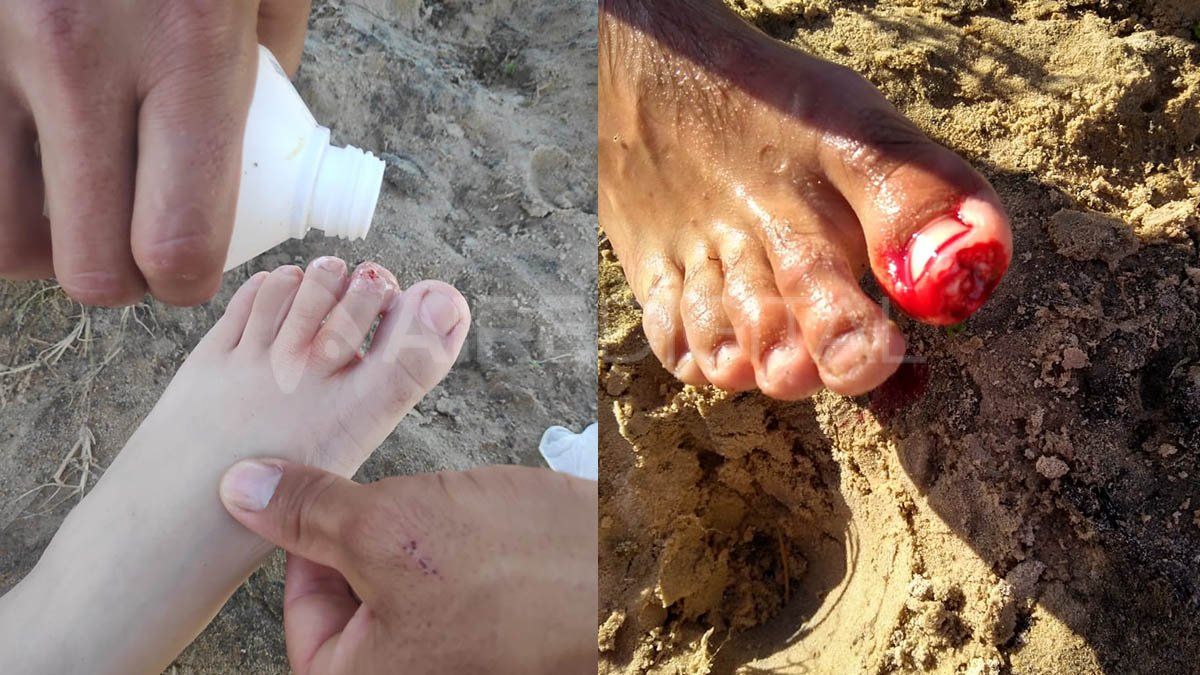 En zona de los Espigones de la Costanera santafesina