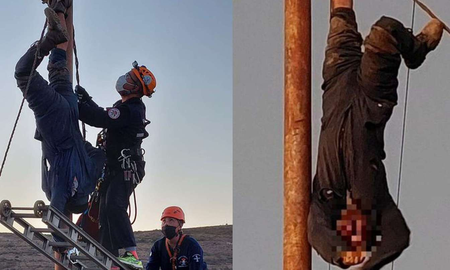 Le amputarán el brazo al hombre que se trepó a robar cables y quedó electrocutado Le amputarán el brazo al hombre que se trepó a robar cables y quedó electrocutado