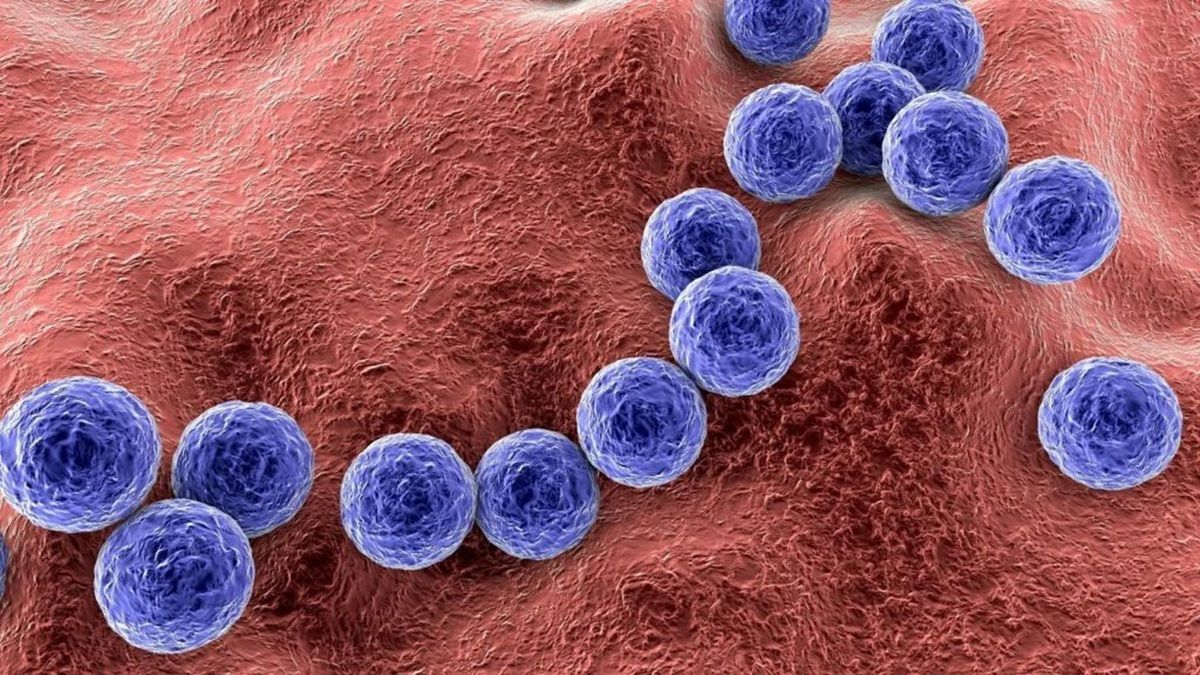 Streptococcus pyogenes es una bacteria de las cuales existen 80 serotipos diferentes.