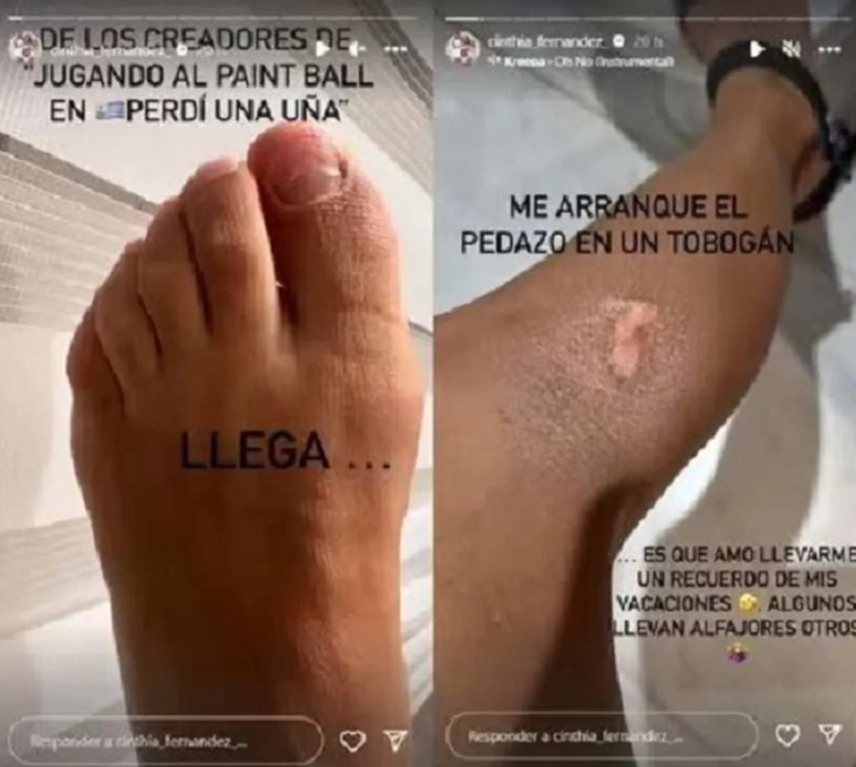Cinthia Fernández compartió en sus redes sociales su accidente. Cinthia Fernández compartió en sus redes sociales su accidente.
