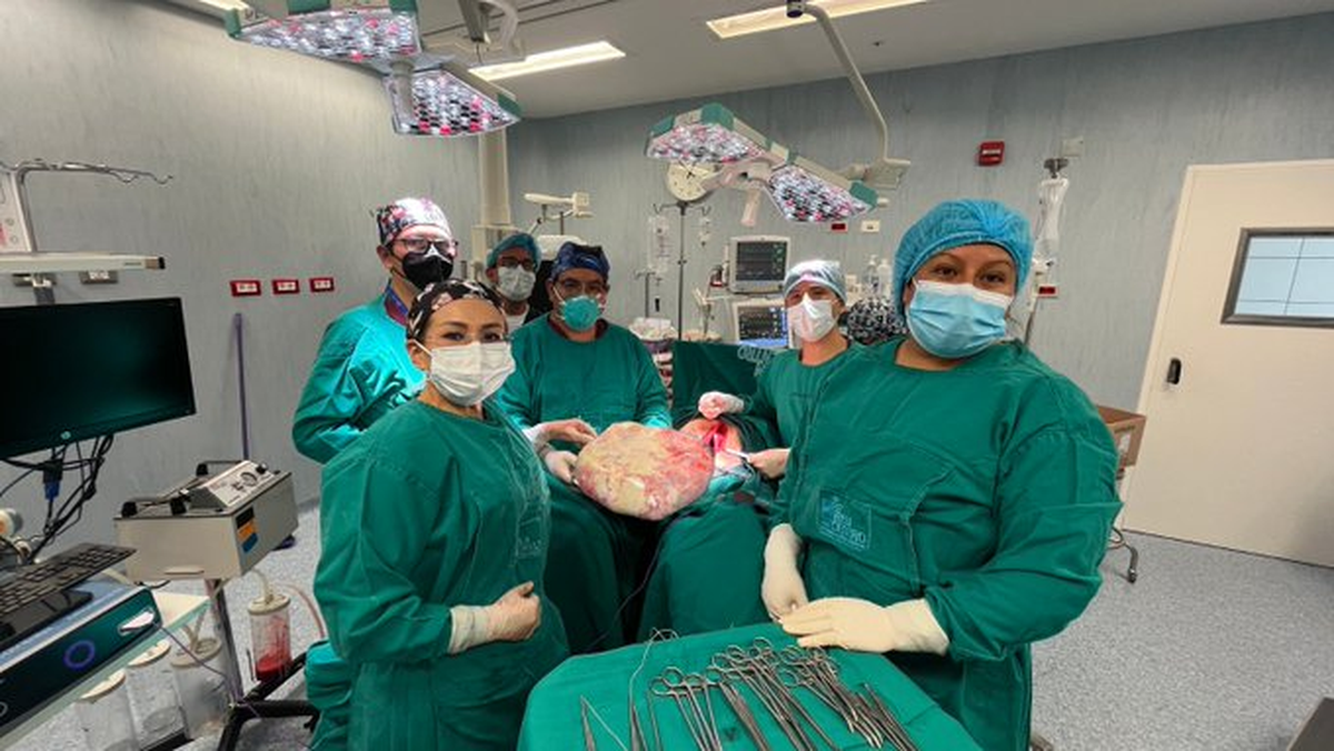 En la imagen, el tumor extirpado.