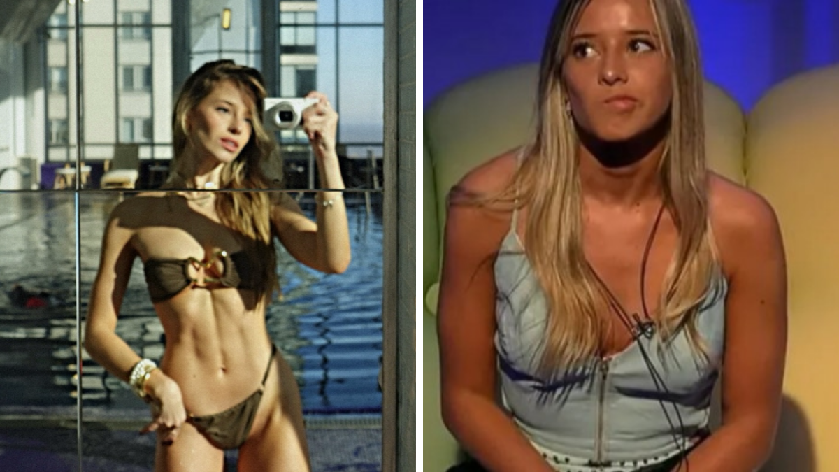 La ex Gran Hermano Zoe Bogach se hizo un retoque estético y fue repudiada en redes.