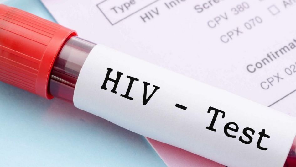 SIDA: el 30% desconoce su diagnóstico