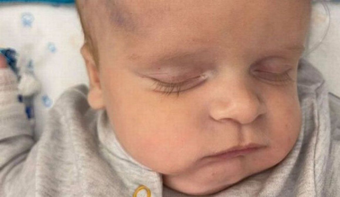 Un bebé recién nacido quedó con daño cerebral tras procedimiento durante el parto: usaron un clip de electrodo