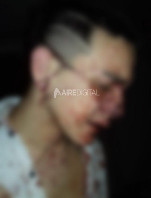 El padre del joven golpeado en un boliche: “Un patovica lo golpeó en el piso”