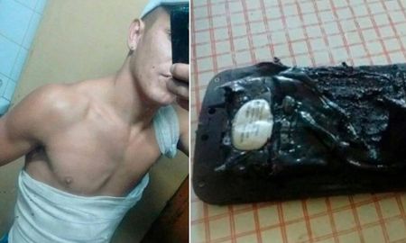 le exploto el celular mientras dormia y sufrio quemaduras en su cuerpo le exploto el celular mientras dormia y sufrio quemaduras en su cuerpo