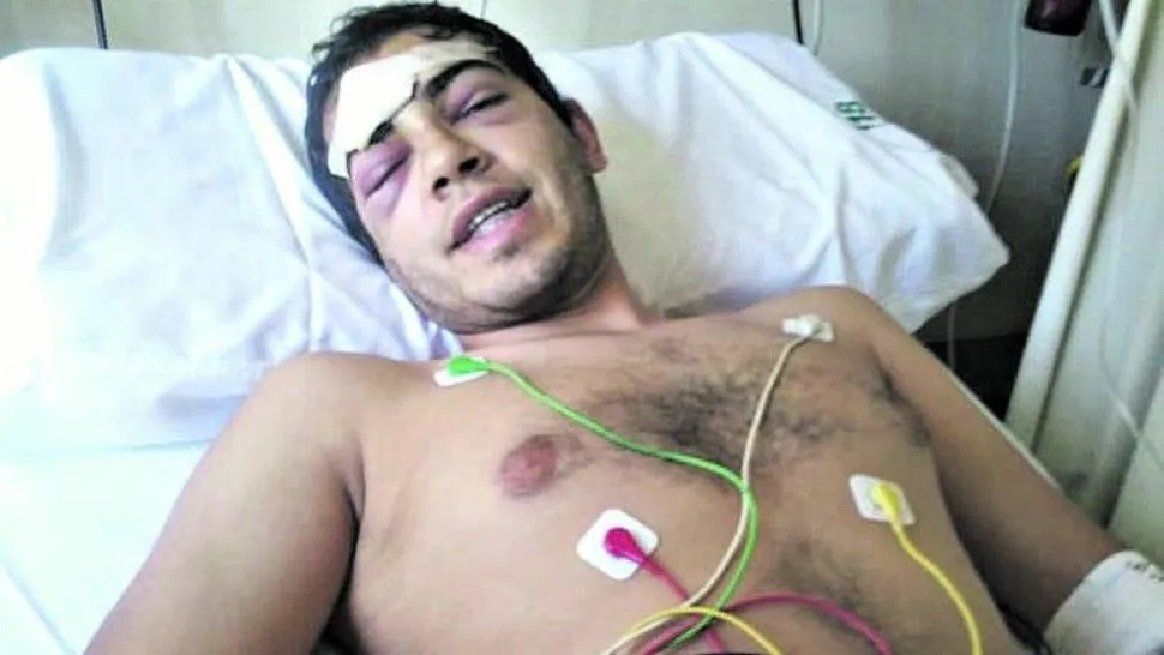 Una patota lo golpeó en un boliche y tiene fractura de cráneo