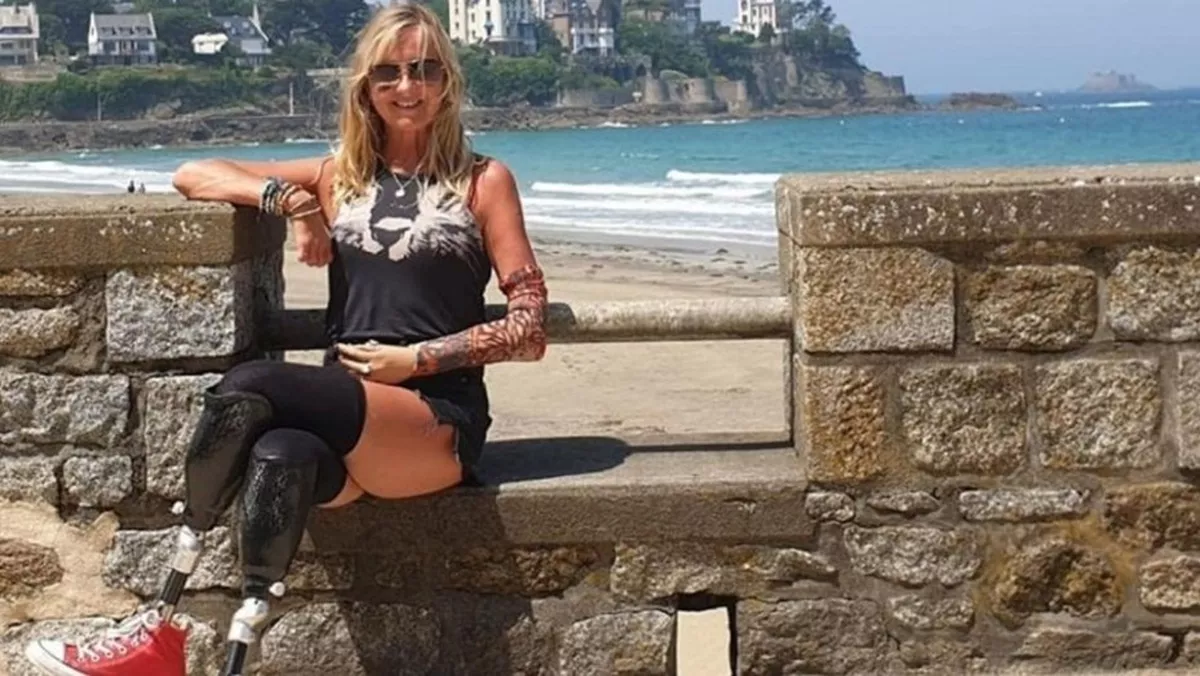 Jayne Carpenter ten&iacute;a 53 a&ntilde;os cuando sufri&oacute; la terrible enfermedad que inici&oacute; como una tos com&uacute;n hasta que se volvi&oacute; una sepsis.