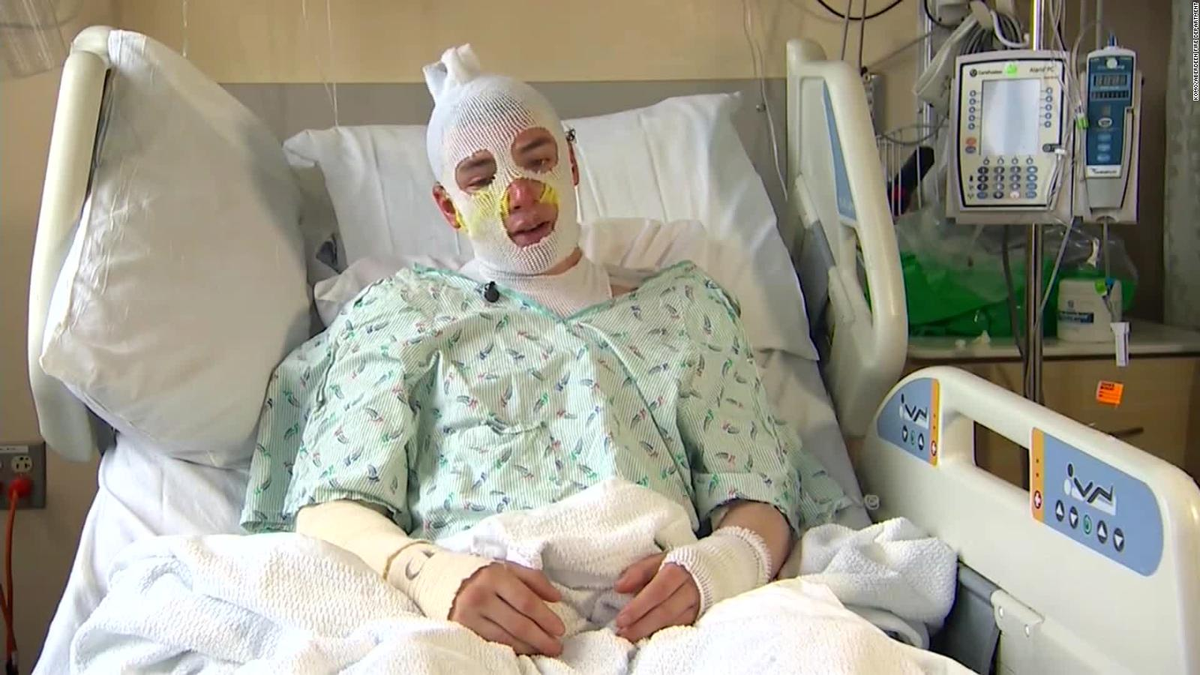 Derrick Byrd de Washington, Estados Unidos, salvó a su sobrina de un incendio.