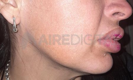 El sábado por la noche, una mujer sufrió el violento robo de su moto en inmediaciones de Hipólito Irigoyen y Saavedra. El sábado por la noche, una mujer sufrió el violento robo de su moto en inmediaciones de Hipólito Irigoyen y Saavedra.