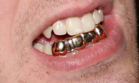 Un par de hombres intentaron contrabandear casi un kilo de oro en sus prótesis dentales.