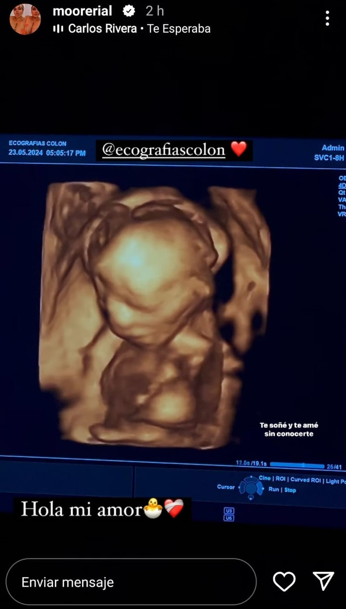 Morena Rial publicó una ecografía de su segundo hijo. Morena Rial publicó una ecografía de su segundo hijo.