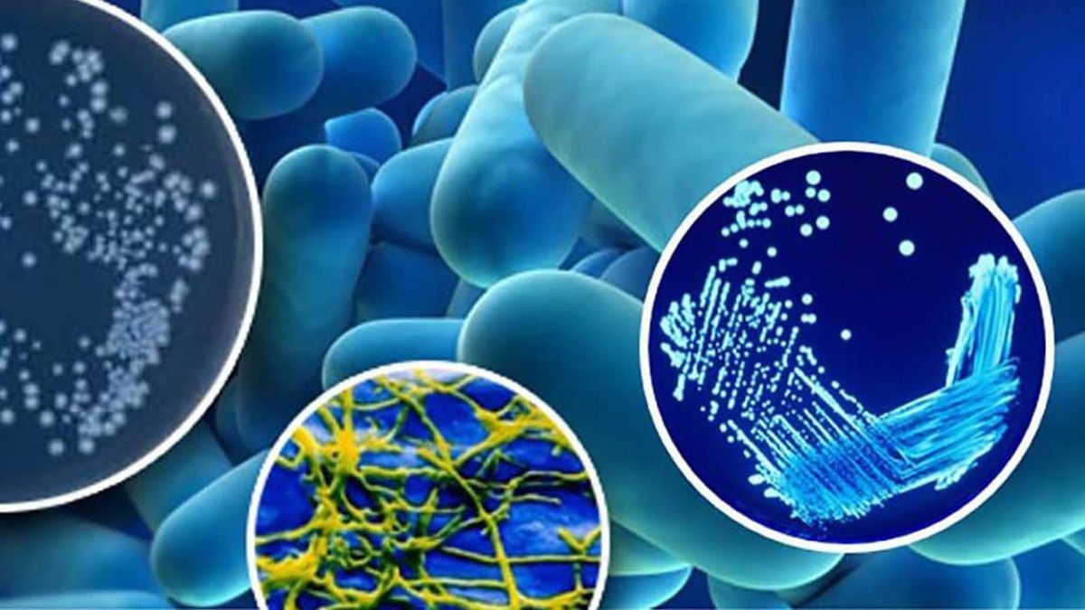 La enfermedad generalmente se presenta entre dos y diez días después de la exposición a la bacteria de la legionela. Normalmente comienza con síntomas como dolor de cabeza, dolores musculares y fiebre alta (alrededor de 40°).