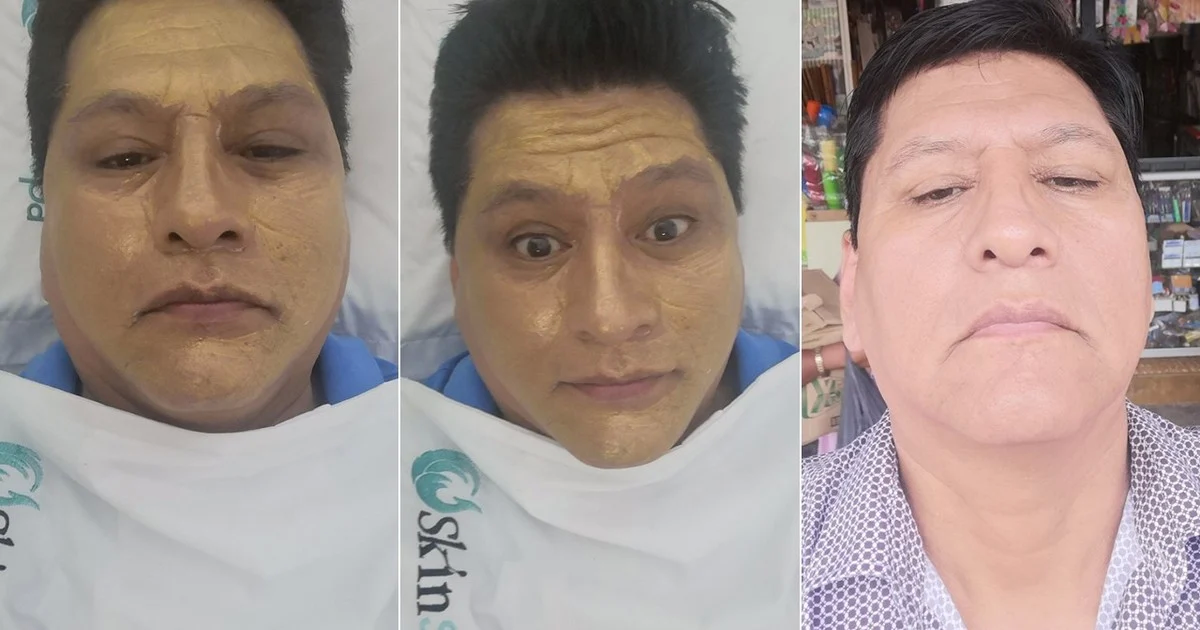 Cuando lo expulsaron de Bolivia, José Miguel Farfán se modificó el rostro con cirugías estéticas.