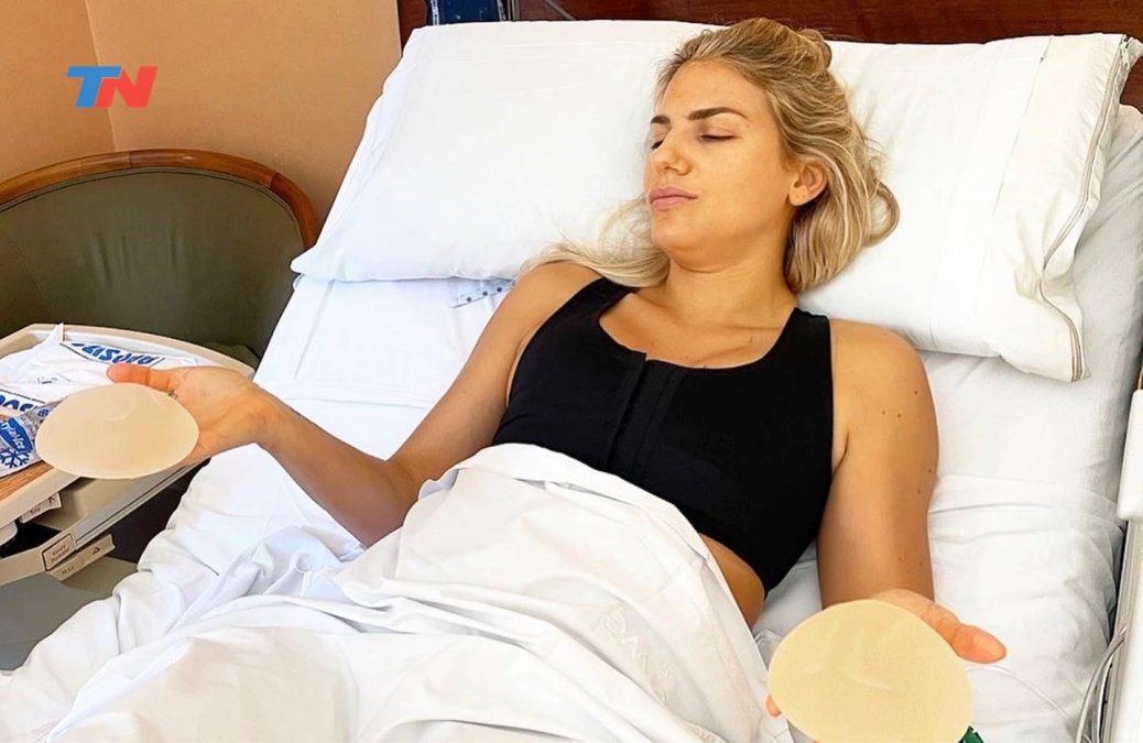 Carolina Oltra pasó por el quirófano para quitarse los implantes mamarios y habló de su decisión: le dije basta a estas bolsas tóxicas