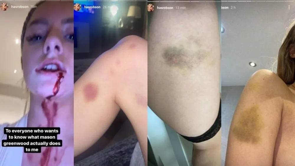 Algunas de las im&aacute;genes que comparti&oacute; Harriet Robson en su cuenta de Instagram.