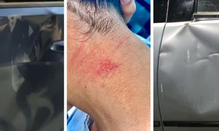 En primera instancia un jugador fue mordido en el cuello durante uno de los partidos y luego, los coches fueron dañados presuntamente por barras bravas de Newells, segun denunciaron. En primera instancia un jugador fue mordido en el cuello durante uno de los partidos y luego, los coches fueron dañados presuntamente por barras bravas de Newells, segun denunciaron.