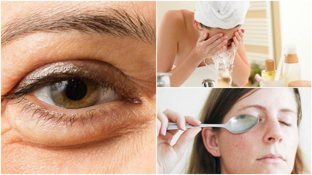 6 métodos naturales para reducir las bolsas bajo los ojos.jpg
