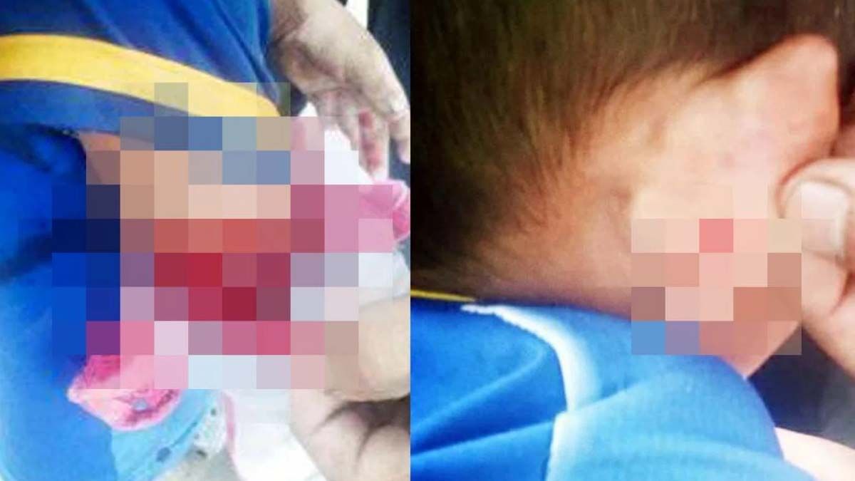 Imputaron a la madre que atacó a sus hijos con un machete porque compraron $20 de golosinas