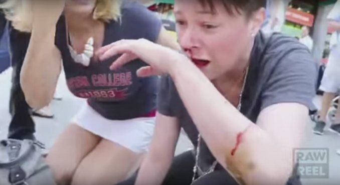 Un pitbull atacó ferozmente a un beagle en la calle