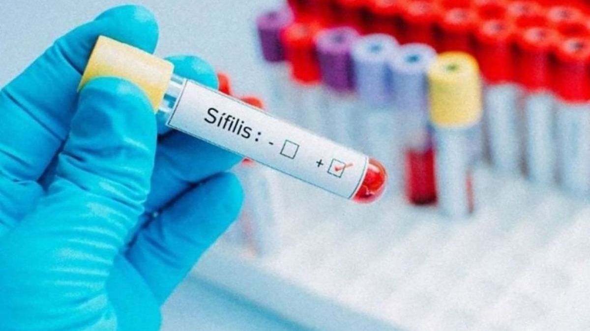Aseguran que el aumento de los casos de sífilis se debe a la falta de educación sexual integral.&nbsp;