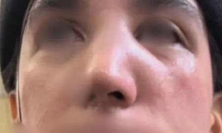 El hombre las golpeó por su vestimenta. El hombre las golpeó por su vestimenta.