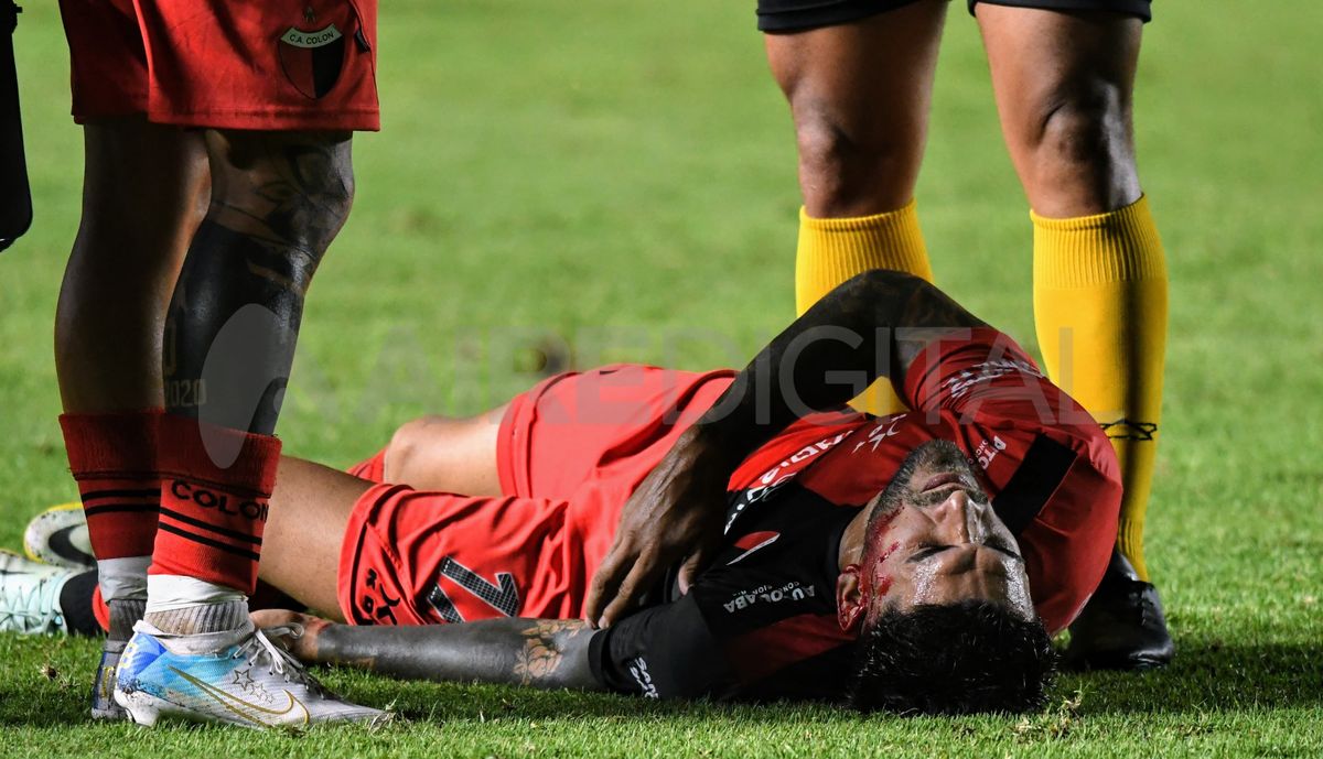 Javier Toledo recibió un codazo en el rostro y tuvo que salir de la cancha.