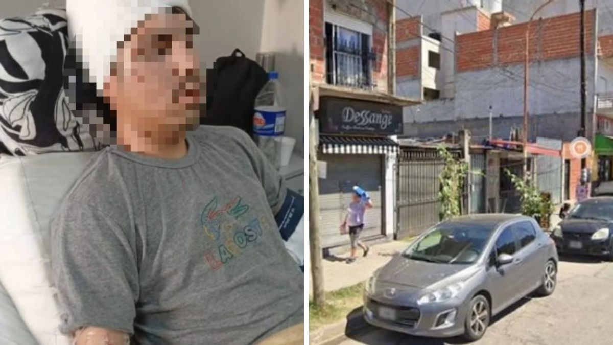 Fue golpeado con martillo en la cabeza tras una discusión en el colectivo.