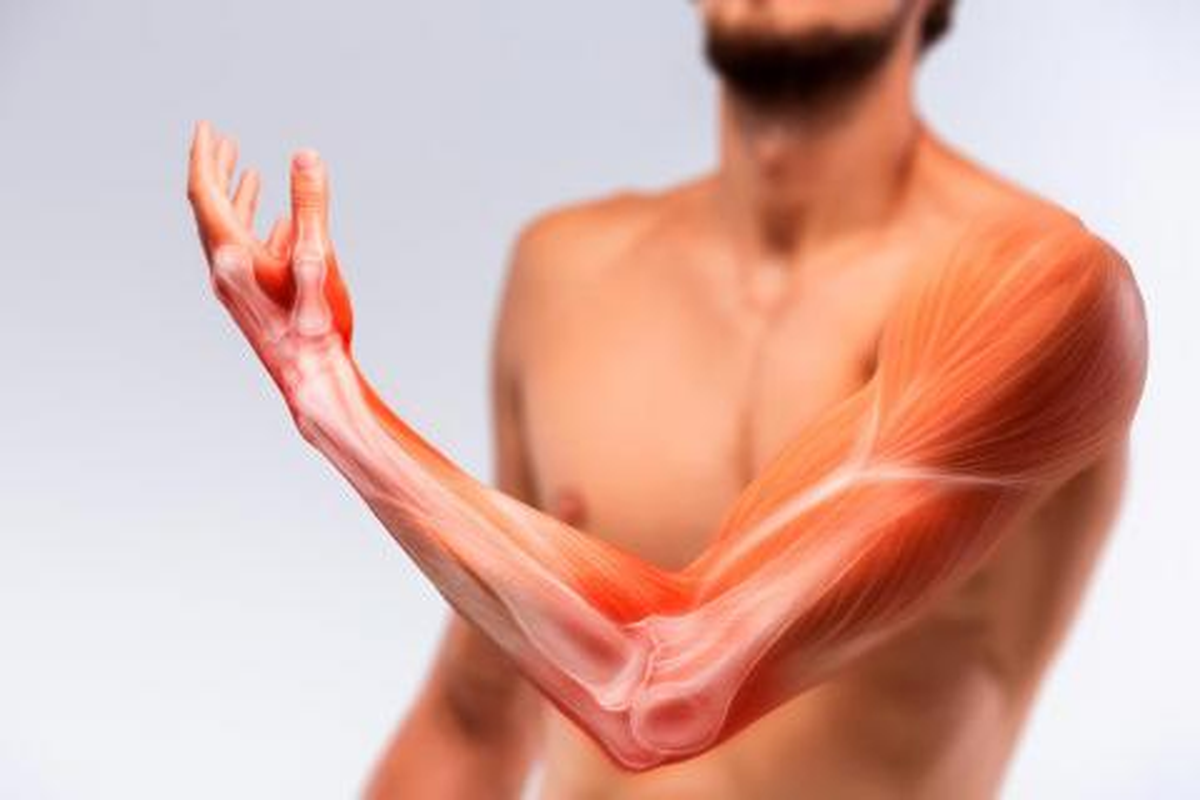 El sarcoma es un tipo de cáncer que puede encontrarse tanto en tejidos blandos como en tejidos óseos.