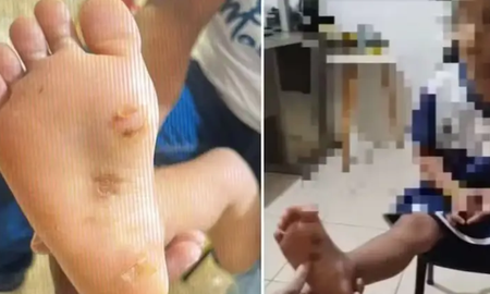 Detuvieron a una pareja acusada de torturar a su hija en Brasil la nena tenía quemaduras Detuvieron a una pareja acusada de torturar a su hija en Brasil la nena tenía quemaduras