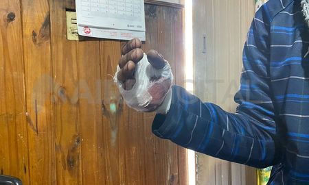 Así quedó la mano de la víctima tras el disparo. Así quedó la mano de la víctima tras el disparo.
