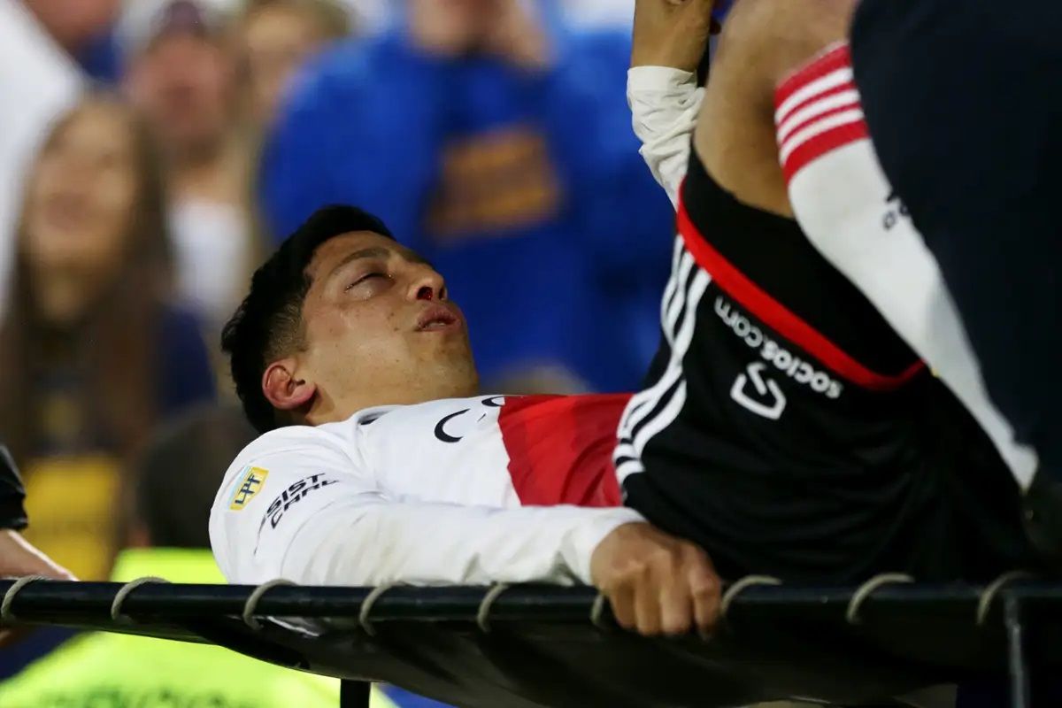 Rodrigo Aliendro fue intervenido quirúrgicamente por la grave lesión que sufrió en su rostro durante el último superclásico.