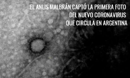 la primera foto del virus sars-cov-2 que circula en argentina la primera foto del virus sars-cov-2 que circula en argentina