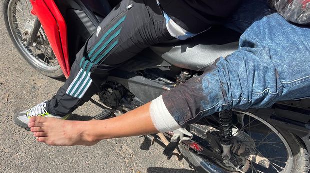 La víctima fue asistida en el hospital Cullen y obtuvo el alta este domingo por la mañana.&nbsp;