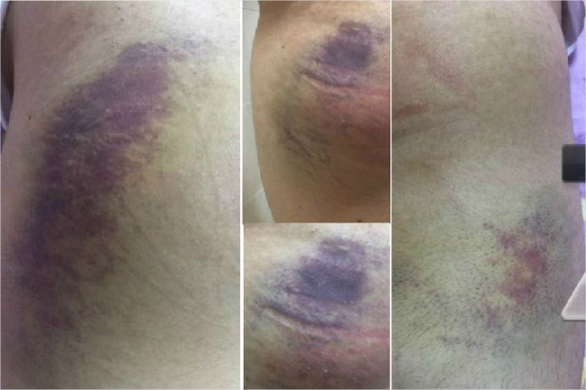 Los integrantes del The East Light afirmaron que, como aprendices, su productor los golpeó durante cuatro años y mostraron las pruebas.