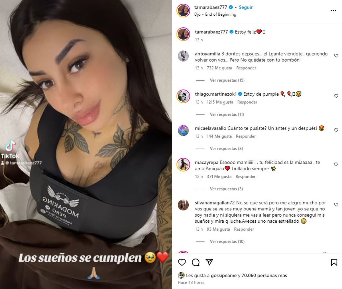 Tamara Báez, feliz con su cirugía estética. Tamara Báez, feliz con su cirugía estética.