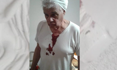 Mario Kovacevich debió ser asistido por los golpes