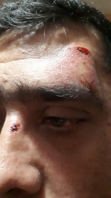 El subjefe de la subcomisaría 1° con escoriaciones en el rostro