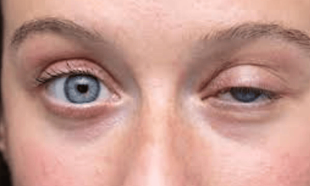 El temblor en los ojos, además de ser un síntoma físico relacionado con el estrés y la salud, tiene significados espirituales diferentes según la cultura y el ojo afectado.