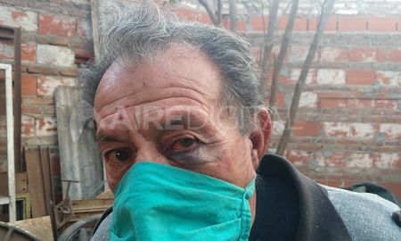 Golpes de puño. Me siento muy dolorido, explicó el propietiario del taller tras el asalto. Golpes de puño. Me siento muy dolorido, explicó el propietiario del taller tras el asalto.