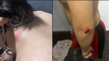 Santo Tomé: denuncian que un joven fue golpeado con una pala durante una pelea entre vecinos