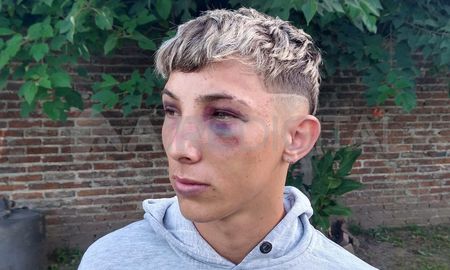 Patovicas golpearon brutalmente a un joven en un boliche de la ruta nacional 168 Patovicas golpearon brutalmente a un joven en un boliche de la ruta nacional 168