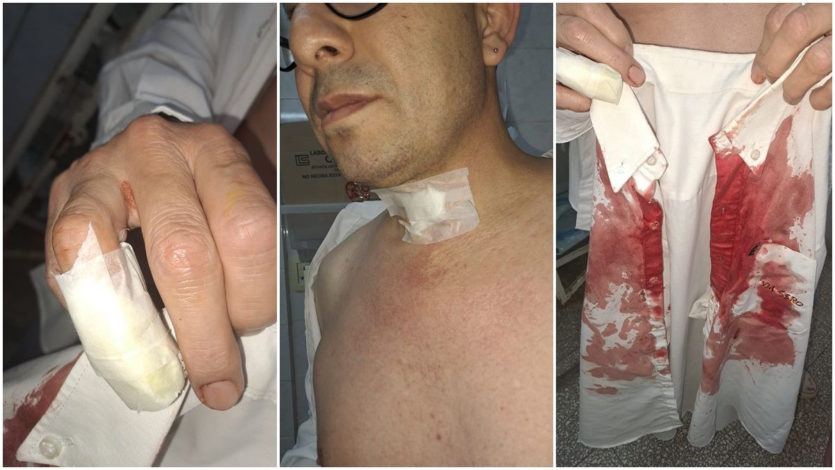 El hecho ocurrió este miércoles durante la madrugada en el oeste de la ciudad.&nbsp;