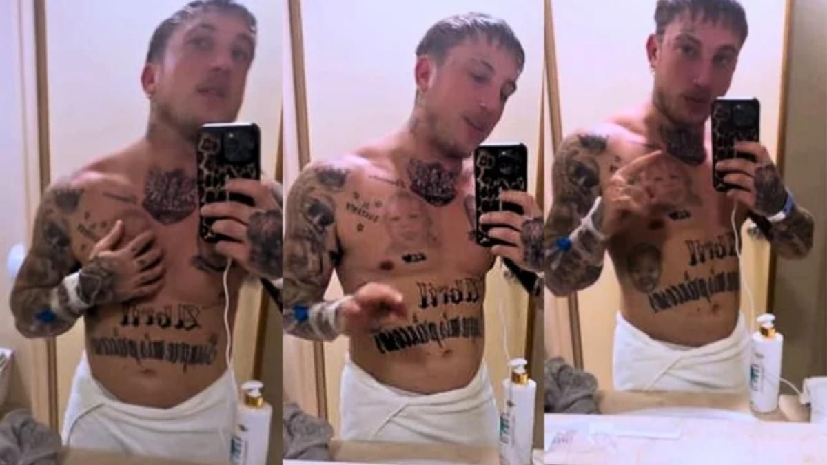 El Polaco negó tener un forúnculo.&nbsp;