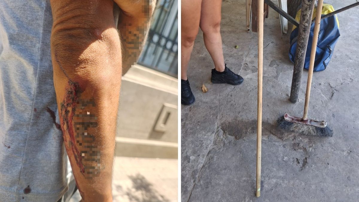 Santa Fe: agredido con un palo de escoba