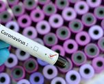 coronavirus: son 266 los confirmados y podria haber transmision comunitaria coronavirus: son 266 los confirmados y podria haber transmision comunitaria