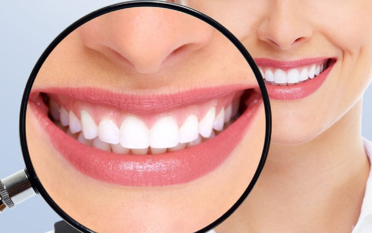 Remedios caseros para eliminar el sarro de los dientes