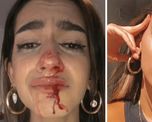 Una influencer trans sufrió una brutal golpiza en la calle Una influencer trans sufrió una brutal golpiza en la calle
